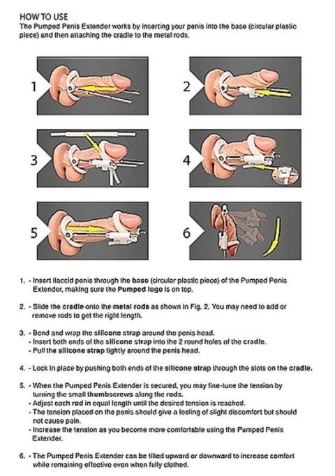Penis Extender - White Pumped